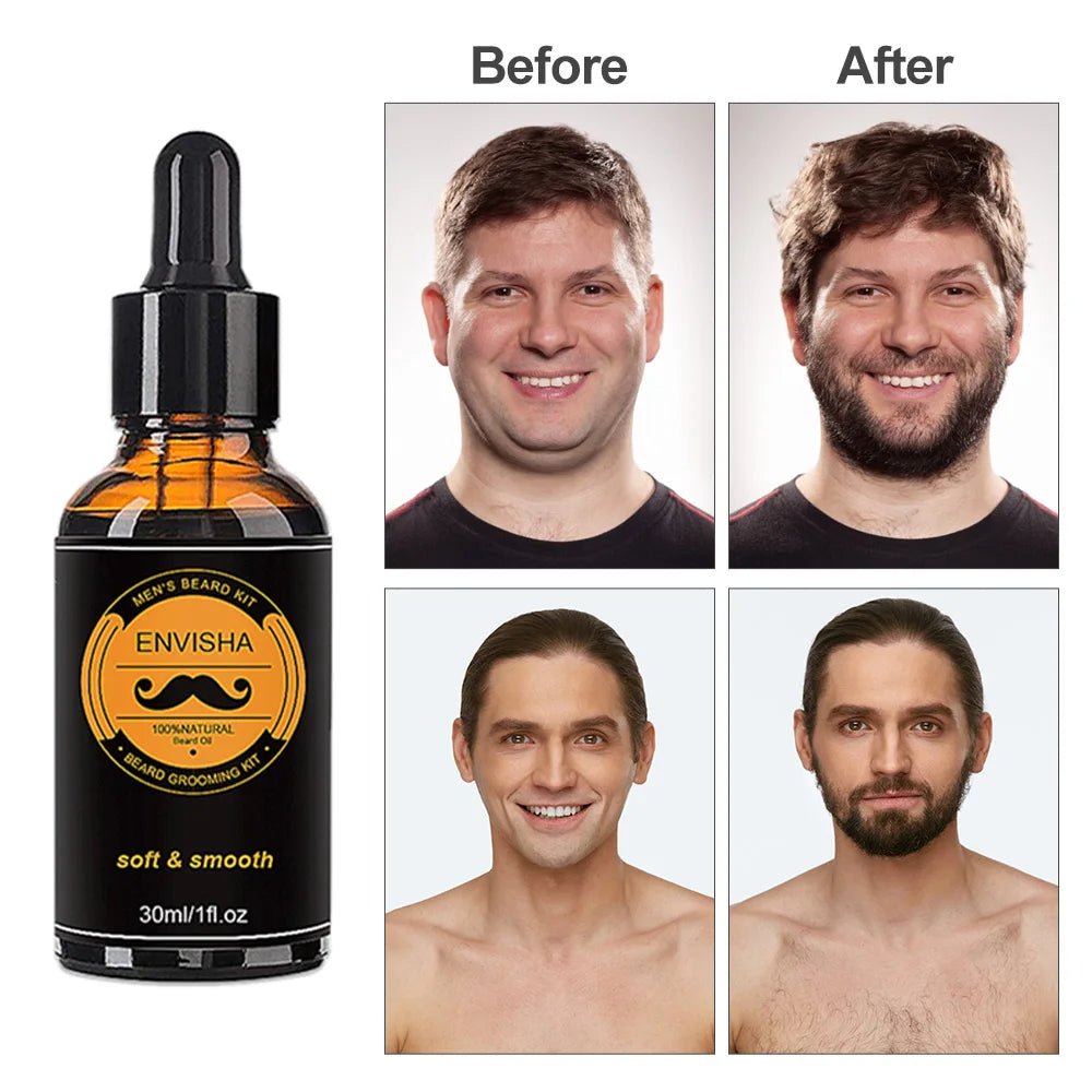 Beard Growth Kit For Men - Beauty Emporium Beard Growth Kit 14:200006151#type 1;200007763:201336106